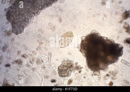 128 X, vergrößert diese photomicrograph die Anwesenheit eines trematode offenbart, Fasciola hepatica, oder? Schaf Leberegel?, Ei, die als weitgehend Ellipsoide, operculated und Messen 130 {Micro}m zu 150{Mikro} m lang durch 60{Mikro} m 90{Mikro} m Breite beschrieben wird. Die Eier sind unembryonated Wenn in den Fäzes weitergegeben. Die Eier von F. Leberblümchen kann schwierig sein von Fasciolopsis spp. zu unterscheiden, obwohl die abopercular Ende des ehemaligen oft eine Aufgeraut oder unregelmäßig. <b><u>klinische Merkmale:</u></b>. Bild mit freundlicher Genehmigung von CDC/Dr. Mae Melvin, 1979. Stockfoto