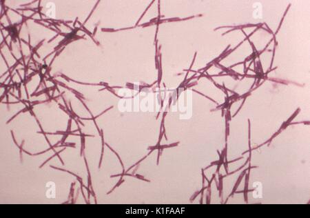 Dieses Gram-gebeizt photomicrograph zeigt zahlreiche stäbchenförmige Bakterien Bacillus anthracis, die miteinander verknüpft hatte lange filamentöse Ketten zu bilden, Anthrax ist eine natürlich vorkommende Krankheit von Tieren (z.b. Schafe, Ziegen und Rinder), die durch das Bakterium Bacillus anthracis der Bakterien im Boden in vielen Teilen der Welt leben und Form äußere Schichten als Sporen (nachstehend Anthrax Sporen) Sporen in der Lage sind, harte oder ungünstigen Bedingungen, die in der Regel Bakterien Tiere töten zu widerstehen, durch einnehmen von Anthrax anthrax Sporen aus dem Boden Milzbrand in Tiere erhalten können Auftritt worldw Stockfoto