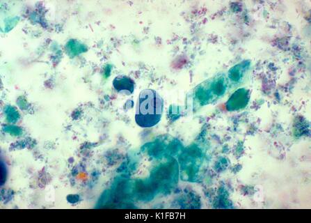 Diese trichrom-gebeizt Entamoeba histolytica schieben eine trophozoite mit seinen typischen Kern offenbart. E. histolytica excystation, d. h. die Flucht aus der Zyste, tritt in den Dünndarm und trophozoiten sind freigegeben, der in den Dickdarm zu migrieren. Die trophozoiten multiplizieren durch binäre Spaltung und produzieren Zysten, die im Kot weitergegeben werden. Bild mit freundlicher Genehmigung von CDC/Dr. Mae Melvin, 1977. Stockfoto