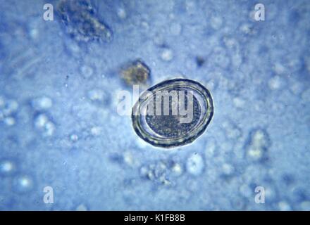 Diese Aufnahme zeigt eine befruchtete Eizelle des runden Wurm Ascaris lumbricoides, Mag. 400 X. Befruchtete Eier sind gerundet, haben eine dicke Schale. Während unbefruchtete Eier sind länglich und größere, dünner geschält, durch ein sichtbarer mammillated Schicht, die manchmal von protuberanzen abgedeckt ist. Bild mit freundlicher Genehmigung von CDC/Dr. Mae Melvin, 1982. Stockfoto