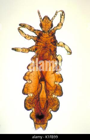 Dieses Bild zeigt eine dorsalansicht Für eine weibliche Kopflaus, Pediculus humanus capitis Div. Läuse sind parasitäre Insekten, die auf die Köpfe der Menschen gefunden werden können, und Einrichtungen, einschließlich der Schambereich. Die Läuse überleben durch die Fütterung von menschlichem Blut. Läuse gefunden auf jeder Bereich des Körpers voneinander unterscheiden. Die drei Arten der Läuse, die auf Menschen leben sind:. Bild mit freundlicher Genehmigung von CDC/Dr. Dennis D. Juranek, 1979. Stockfoto