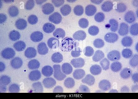 Blutausstrich wachsendes trophozoite Plasmodium vivax. Parasiten. Bild mit freundlicher Genehmigung von CDC/Dr. Mae Melvin. 1981. Stockfoto