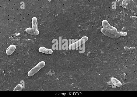 Diese Scanning Electron Micrograph (SEM) eine Reihe von Gram-negativen Bakterien Bordetella bronchiseptica coccobacilli dargestellt. Dieser Organismus ist häufig die Ursache von Infektionen der Atemwege bei Hunden, sowie Menschen, deren Immunsystem, einschließlich derer, die durch das HIV-Virus infiziert sind verglichen worden war. Genetisch sehr ähnlich und eng mit B. pertussis, die in der Tatsache, dass es auch besitzt das Gen zu Pertussis toxin Express bewiesen wird, dieser Bordetella Mitglied hat das Toxin wie seine Gefährten Gattung Mitglied nicht produzieren. Dieses Bakterium kann eine breite Palette o Ursache Stockfoto