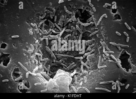 Scanning Electron Micrograph (SEM) von Mycobacterium chelonae Bakterien. Mit freundlicher CDC. 1984. Stockfoto