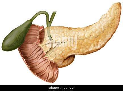 Behinderung der Pankreasgang verhindert das Herausschleudern von pankreassaft in den Zwölffingerdarm. Stockfoto