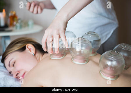 Junge Frau eine Behandlung an der Medizinischen Klinik. Feuer schröpfen Cups auf der Rückseite des weiblichen Patienten in der Akupunktur Therapie Stockfoto