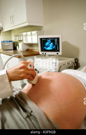 Schwangere junge Frau an die Ultraschallprüfung Stockfoto