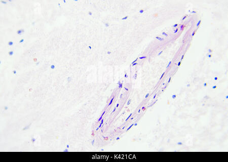 Hirngewebe mikroskopische Ansicht Vergrößerung x 400 Stockfoto