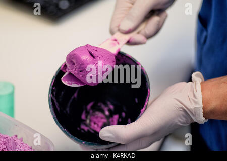 Gemischt dental Alginat Abformmaterial verwendet negative Eindrücke von den Zähnen und Weichgewebe in der Öffnung für diagnostische Untersuchungen zu machen. Stockfoto