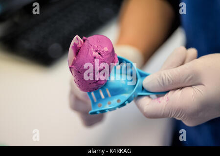 Gemischt dental Alginat Abformmaterial verwendet negative Eindrücke von den Zähnen und Weichgewebe in der Öffnung für diagnostische Untersuchungen zu machen. Stockfoto