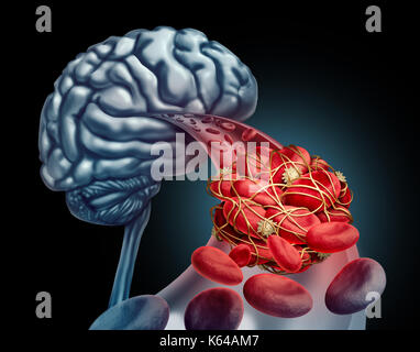 Blutgerinnsel im Gehirn medizinisches Konzept als 3D-Illustration Blutzellen durch eine Arterie Blockierung Thrombus, wodurch eine Blockierung des Blutflusses blockiert. Stockfoto