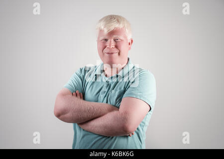 Albino junger Mann portrait. Blonde Kerl auf weißem Hintergrund. Albinismus, blasse Haut. Stockfoto