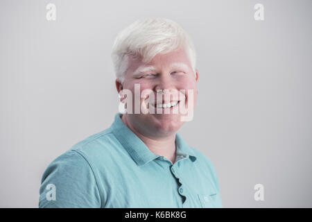 Albino junger Mann portrait. Lächelnd Kerl auf weißem Hintergrund. Albinismus, blasse Haut. Stockfoto