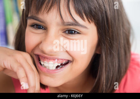 Portrait von ein nettes Mädchen lachend das Tragen einer herausnehmbaren kieferorthopädischen Gerät Stockfoto