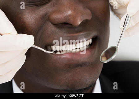 In der Nähe von Doktor Hände tun zahnmedizinische Bis der männlichen afrikanischen Patienten prüfen Stockfoto