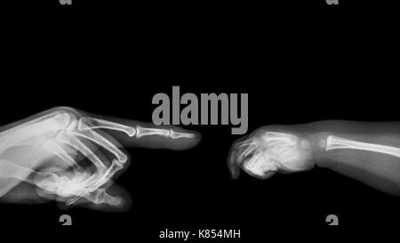 X-Ray's nach Hand zeigen mit dem Finger auf der linken Seite und Baby's Hand auf der rechten Seite. Leere Fläche an die obere Seite. Stockfoto