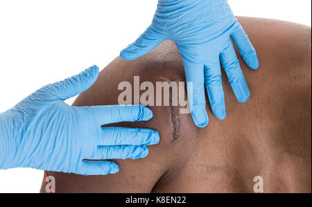 KRANKENSCHWESTER ABGABE PFLEGE Stockfoto