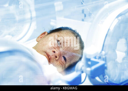 Synthetische Baby, künstliche Intelligenz Roboter Technologie Konzept. Baby mit ai Text im Auge und die Platine auf dem Gesicht. Blue Tone. Stockfoto