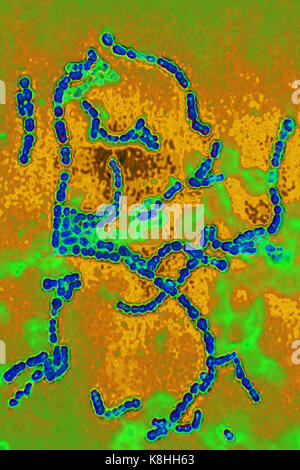 STREPTOCOCCUS PYOGENES Stockfoto