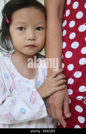 Das Herzinstitut bieten qualitativ hochwertige Pflege an vietnamesischen Patienten, die an Herzkrankheiten leiden. Mädchen mit Mutter. ho Chi minh Stadt. vietnam. Stockfoto