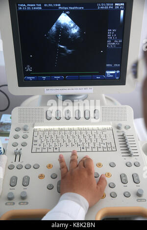 Tam duc Heart Hospital. Doppler Echokardiographie. Ho Chi Minh Stadt. Vietnam. Stockfoto