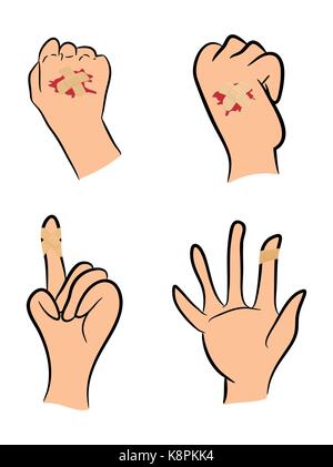 Satz von verletzten Finger und Hand mit Pflaster und rote Pfütze. Vector Illustration auf weißem Hintergrund. Stock Vektor