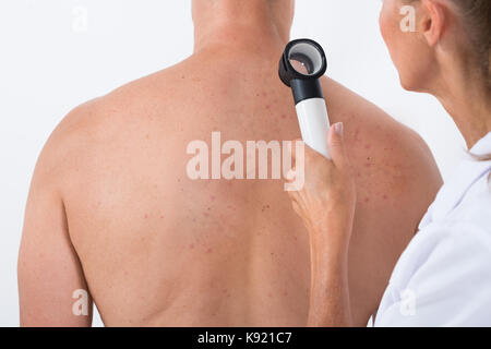 Ärztin untersuchen Akne Haut des Patienten wieder mit Dermatoskop Stockfoto