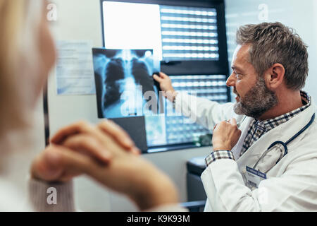 Arzt diskutieren Sie die Prüfergebnisse mit Patienten in der Klinik. Männliche Radiologe Untersuchung der Brust mit den Patienten scannen. Stockfoto