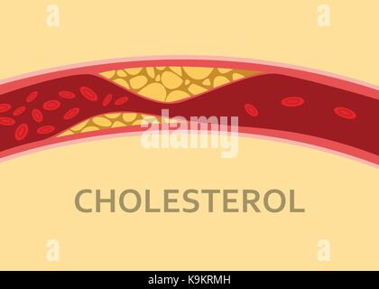 Ein Cholesterin menschlichen Körper mit Blut Zelle stream Stock Vektor