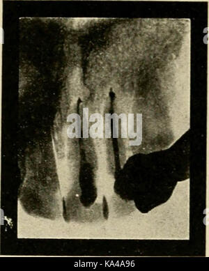 "Elementare und zahnmedizinische Radiographie/von Howard Riley Raper' (1918) Stockfoto