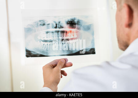 Nahaufnahme der männlichen Arzt auf Zähne X-ray Stockfoto