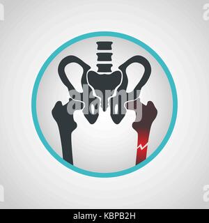 Knochenbruch logo Vektor Icon Design Illustration Stock Vektor