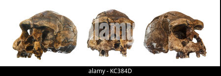 Einstellen des Homo erectus Schädel. 1969 Im Sangiran, Java, Indonesien entdeckt. Zu 1 Millionen Jahren datiert. (Vorne. oblique Ansicht). Stockfoto