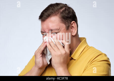 Reifen fat kaukasischen Mann ist krank von Erkältungen oder Lungenentzündung, Niesen in Serviette. Stockfoto