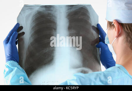 Arzt in der blauen Uniform mit Röntgenstrahlen. Stockfoto