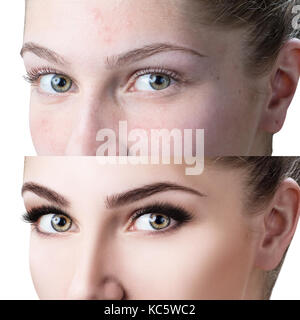 Weibliche Augen vor und nach Eyelash Extension Stockfoto