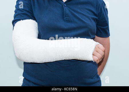 Junge mit gebrochenen Arm, Gips am Arm als Therapie. In der Nähe von white ist ein junger Mann mit langem Arm Gips/Glasfaser Gusseisen für das Handgelenk, Arm und Ellenbogen Stockfoto