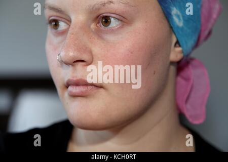 Nahaufnahme eines jungen Krebspatienten mit Kopftuch auf der Seite Stockfoto