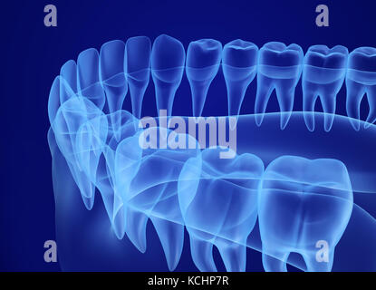 Mund-Zahnfleisch und Zähne-Xray-Ansicht. Medizinisch genaue Zahn 3D-Illustration Stockfoto