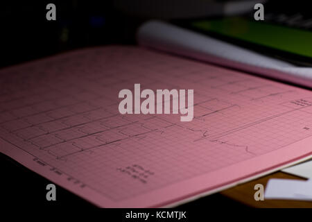 Eine electrokardiogram Druckbogen auf einem Doktorbüro Nahaufnahme Stockfoto
