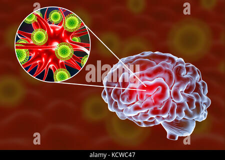 Virale Enzephalitis. Konzeptionelle Abbildung: Gehirn und Nahaufnahme der Viren Nervenzellen zu infizieren. Stockfoto