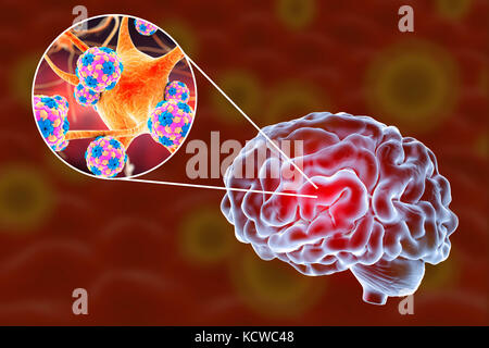 Virale Enzephalitis. Konzeptionelle Abbildung: Gehirn und Nahaufnahme der Viren Nervenzellen zu infizieren. Stockfoto