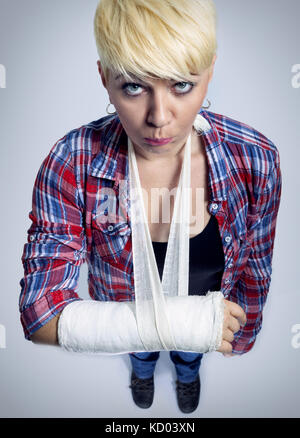 Junge Frau mit einem gebrochenen Arm in Gips Stockfoto