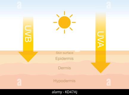 Der Unterschied von Strahlung 2 Arten im Sonnenlicht mit der Haut. Stock Vektor