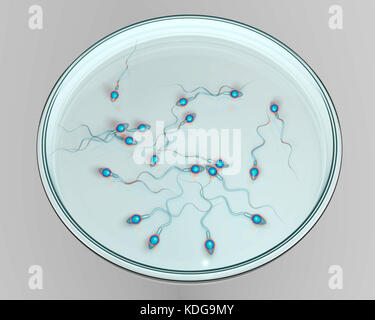 In-vitro-Fertilisation Konzept. Computer Abbildung spermatozoans angezeigt in einer Petrischale warten verwendet werden, um eine Eizelle zu befruchten. Stockfoto