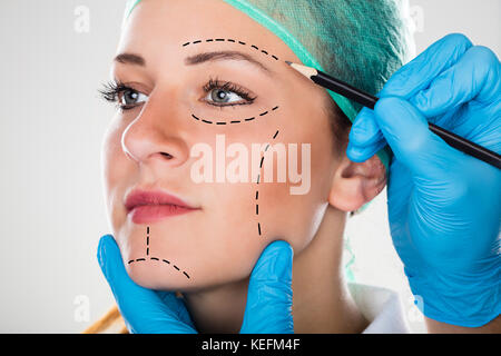 Nahaufnahme eines Chirurgen Zeichnung Perforationslinien auf das Gesicht der jungen Frau Stockfoto