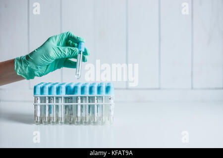 Hand der Krankenschwester im Labor nimmt ein leeres Rohr aus dem Fach für die Entnahme von Blut zur Analyse Stockfoto