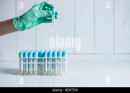 Hand der Krankenschwester im Labor nimmt ein leeres Rohr aus dem Fach für die Entnahme von Blutproben für die Analyse. Stockfoto