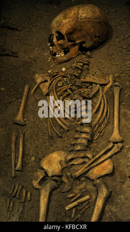 Wikingerzeit. birka Mädchen im Alter von 6 Jahren starb. 10. jahrhundert Skelett. Historische Museum. Stockholm Schweden. Stockfoto