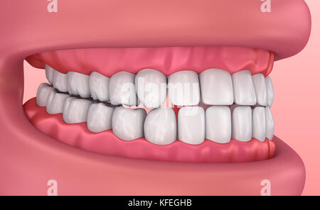 Mund, Zahnfleisch und Zähne. Medizinisch genaue Zahn 3D-Illustration Stockfoto